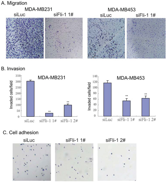 Knockdown of FLI1 inhibits metastasis of breast cancer cells.