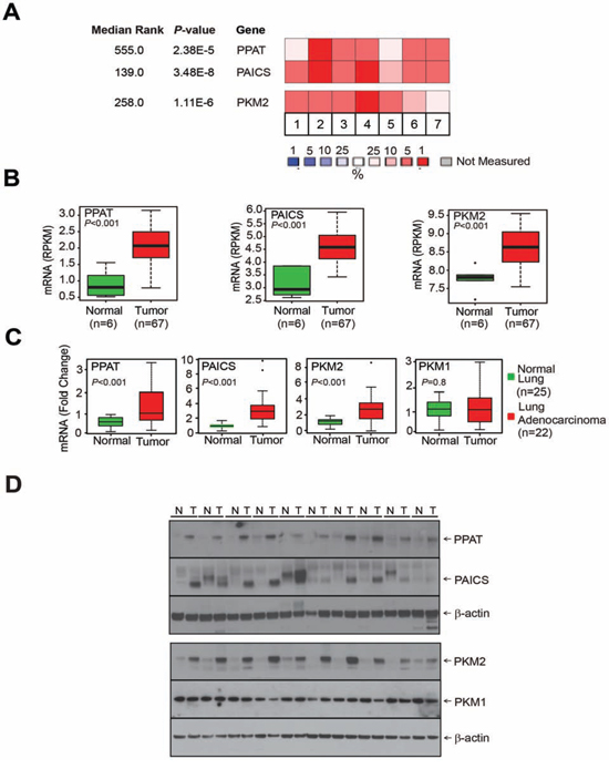 De novo purine biosynthetic enzymes, PPAT &#x0026; PAICS and pyruvate kinase isoform PKM2 are overexpressed in lung adenocarcinoma.