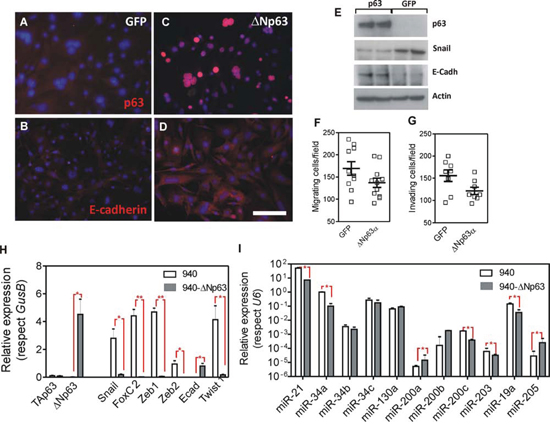 Expression of hu&#x0394;Np63&#x03B1; in 940 cells ameliorates EMT process.