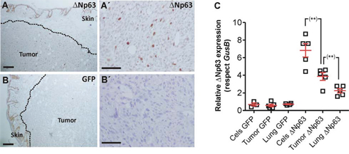 hu&#x0394;Np63&#x03B1; expression is downregulated during spontaneous metastasis development.