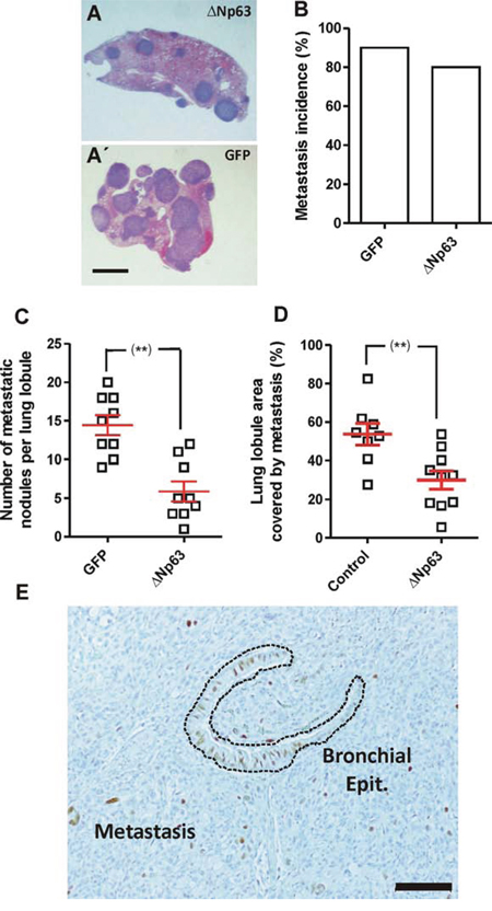 Expression of hu&#x0394;Np63&#x03B1; decreases experimental metastasis development.