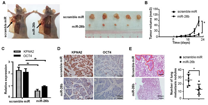 miR-26b/KPNA2/OCT4 axis inhibits EOC growth and metastasis