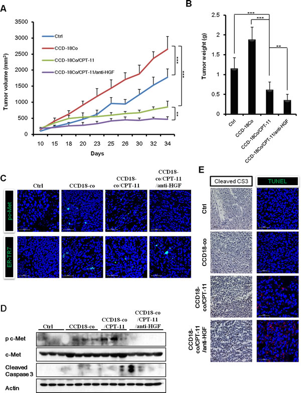 Combination of humanized anti-HGF antibody and CPT-11 inhibits tumor growth