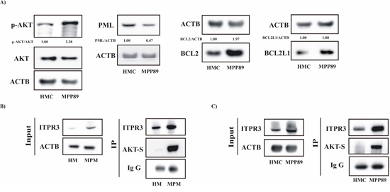 Apoptosis-related proteins regulating the core mechanism of the Ca2&#x002B;-dependent apoptotic pathway are involved in MPM.