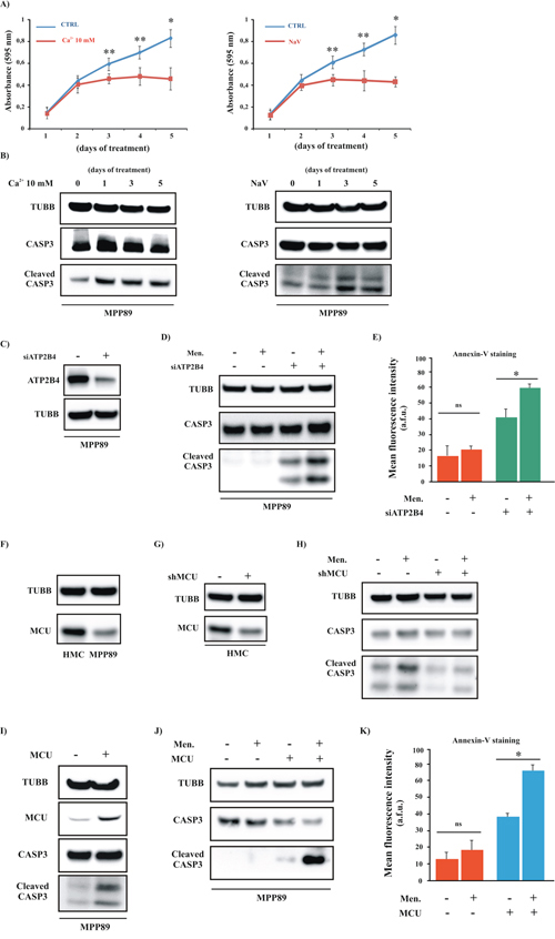 Positive modulation of Ca2&#x002B; handling restores the apoptotic machinery in MPM cell lines.