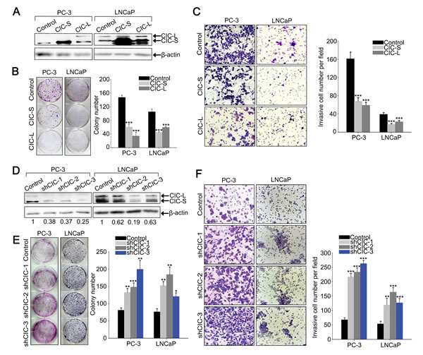 CIC suppresses cell proliferation and invasion in PC-3 cells.