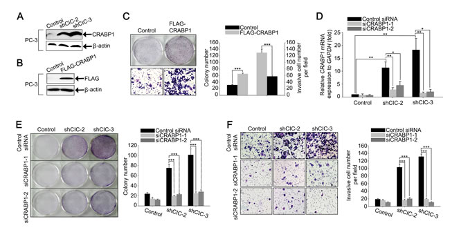 Overexpression of CRABP1 promotes cancer progression in CIC knock-down PC-3 cells.