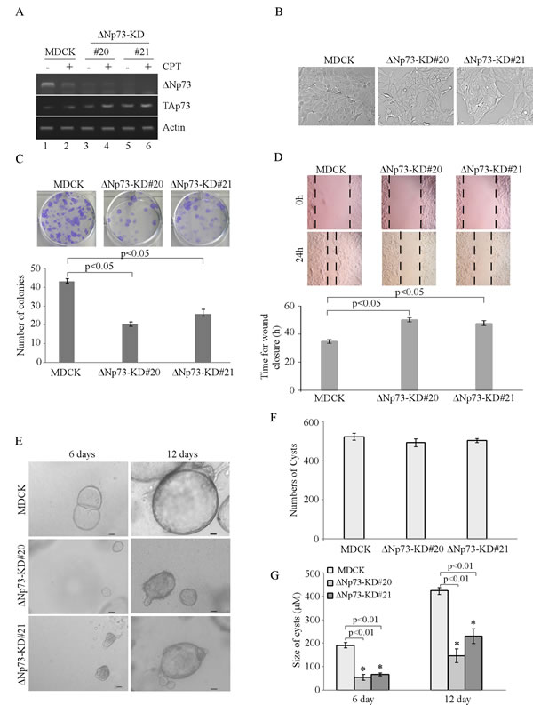 Knockdown of &#x2206;Np73 in MDCK cells suppresses cell proliferation and migration in 2-D culture, and delays cyst formation in 3-D culture.