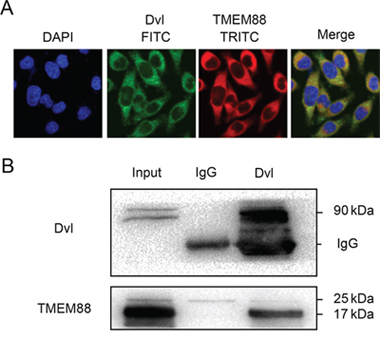 Target protein transmembrane 88(TMEM88) interacts with dishevelled (Dvl).