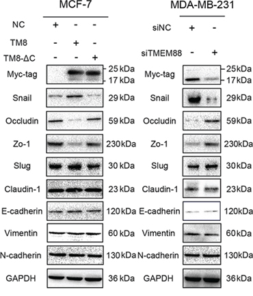 Target protein transmembrane 88(TMEM88) inhibits the expression of Occludin and Zo-1 by promoting Snail expression.