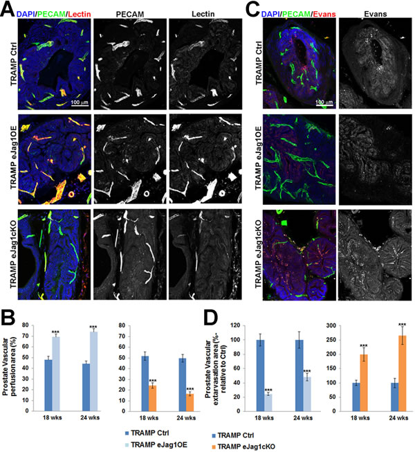 Prostate tumor vascular perfusion and extravasation in TRAMP endothelial-specific