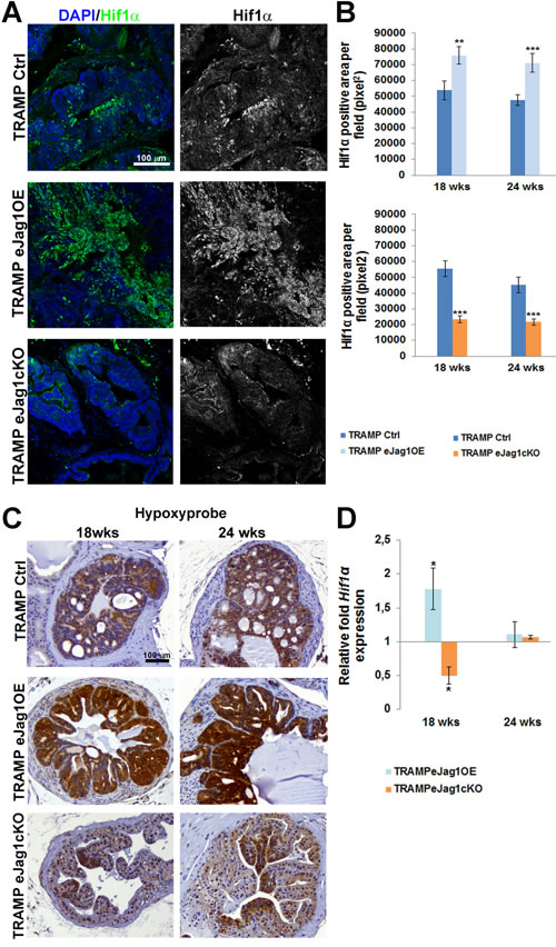 Prostate tumor hypoxic levels in TRAMP endothelial-specific