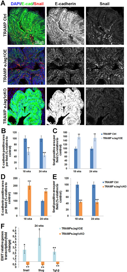 Epithelial-to-mesenchymal transition in prostate lesions of TRAMP endothelial-specific