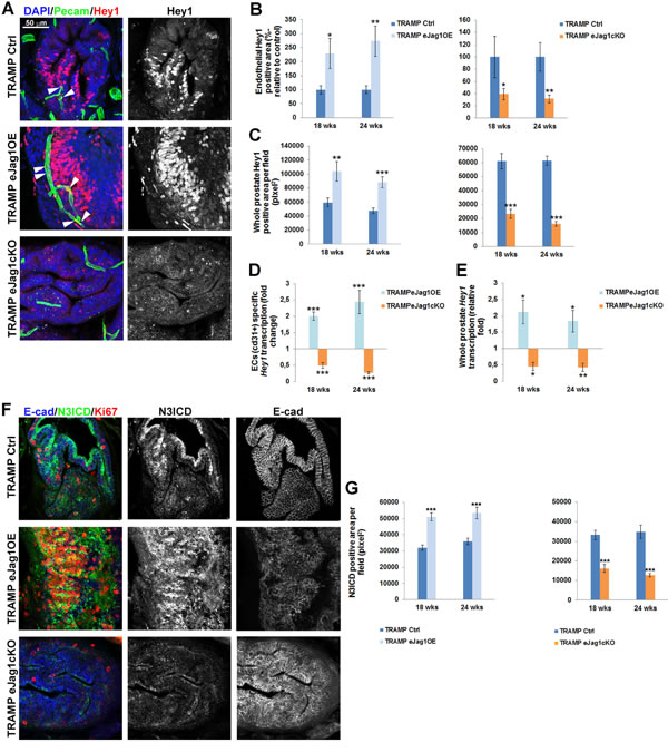 Hey1 transcription and expression and Notch3 intracellular domain (N3ICD) expression in prostate lesions of TRAMP endothelial-specific