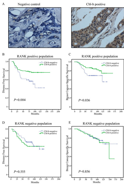 Representative images of Cbl-b immunohistochemical staining in breast cancer and the correlation between Cbl-b expression and patient survival in RANK positive breast cancer patients.