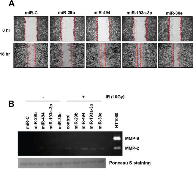 IR-related miRNAs regulate migratory potential and MMP-2 activity in U251 cells.
