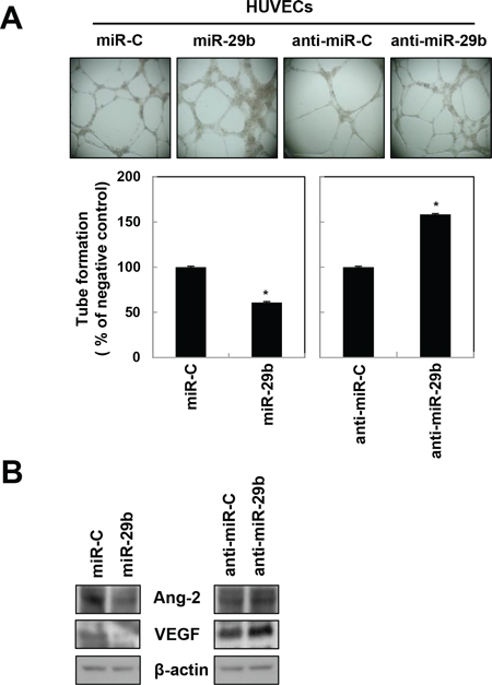 miR-29b attenuates angiogenesis in HUVECs.