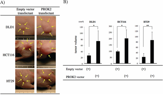 Investigation of Subcutaneous tumor formation in colorectal cancer cells transfected with the PROK2 gene.