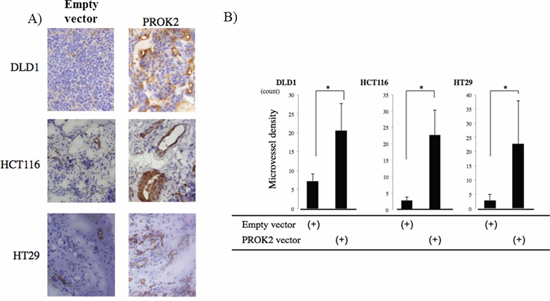 CD31 immunostaining in subcutaneous mice tumors.