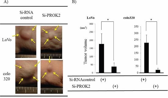 Investigation of Subcutaneous tumor formation in LoVo and colo320 colorectal cancer cells transfected with Si-RNA(PROK2).