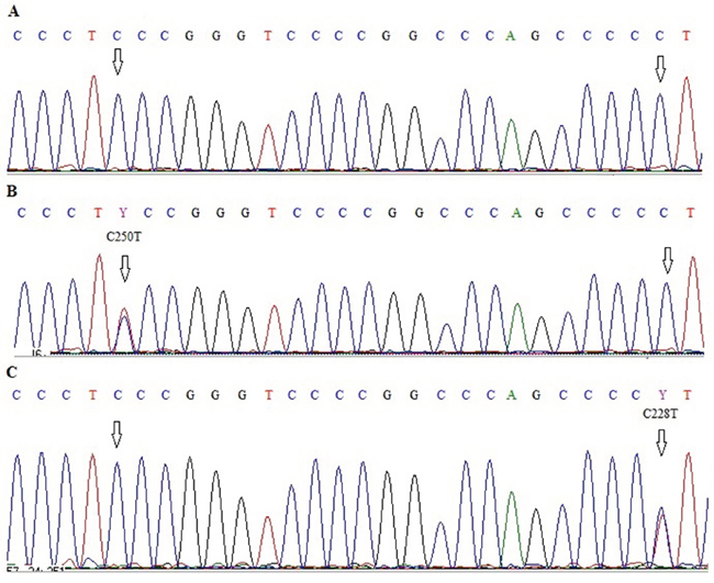 Electropherograms showing sequence of TERT promoter region with two hot-spot mutations C228T and C250T