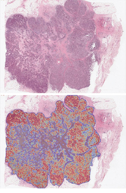 Illustrates how a Tumormap can be generated from the posterior probabilities, highlighting regions of high tumor probability (red) against low tumor probability (blue) and associated color spectrum within the generated tumor boundary.