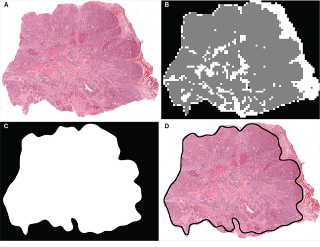 An example showing how a tissue slide is annotated using the automatic tissue identification.