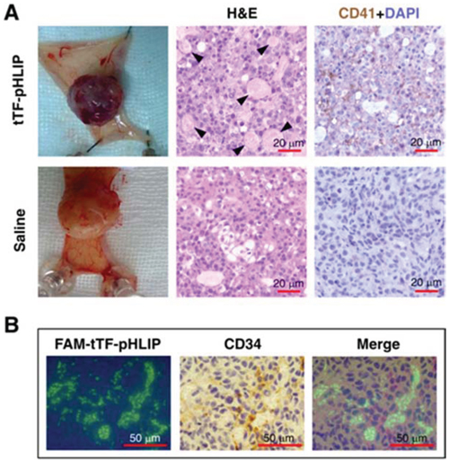 tTF-pHLIP treatment induces thrombosis within tumor vessels, and tumor vessel accumulation of tTF-pHLIP.