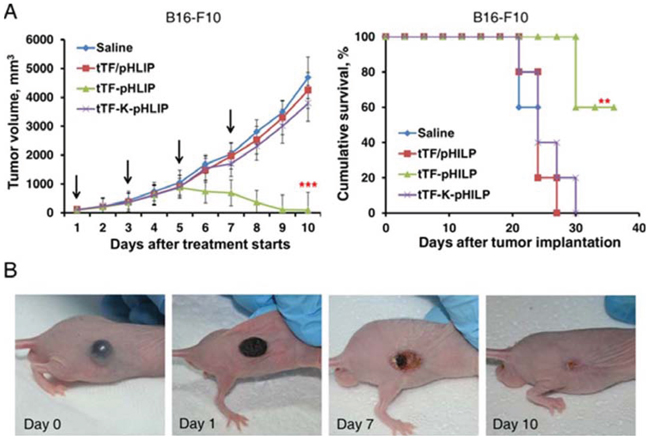 Antitumor activity of tTF-pHLIP in B16-F10 melanoma model.