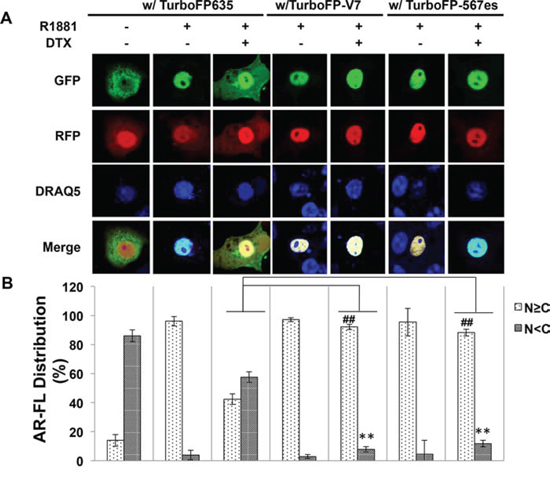 Cytoplasmic sequestration of AR-FL by docetaxel is attenuated by AR-V7 and ARv567es.