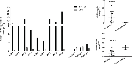 miR-21 is upregulated and OPG downregulated in MM patient-derived BMSCs.