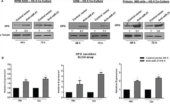 Constitutive miR-21 inhibition significantly increases OPG production.