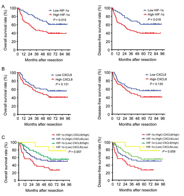 The impact of HIF-1&#x3b1; and CXCL8 expressions on the survival of HCC patients.