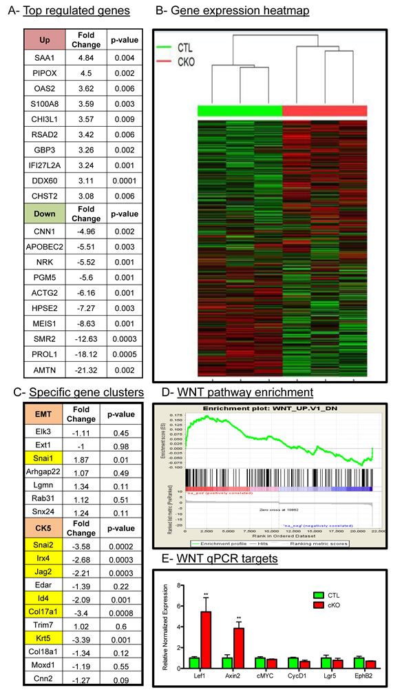 Microarray analysis of control and BMPR1a deleted tumors.