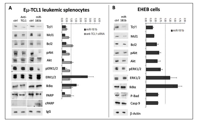 miR-181b modulates key factors involved in CLL.