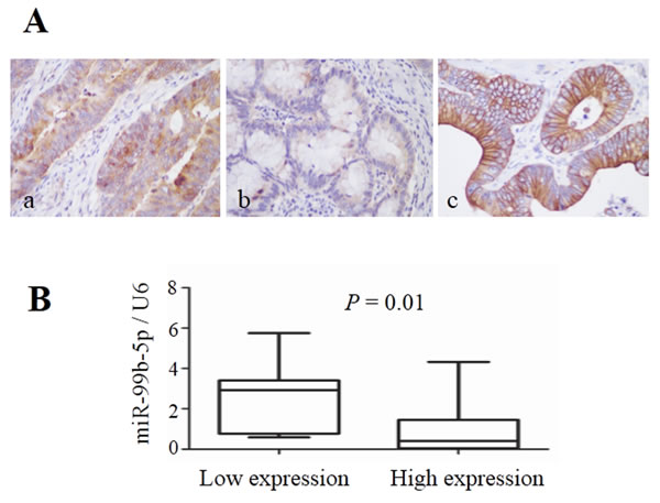 Expression of mTOR in colorectal cancer liver metastases and its relationship with miR-99b-5p.