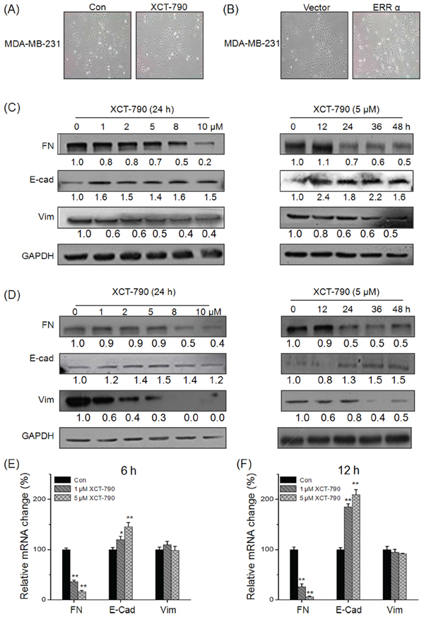 Targeted inhibition of ERR&#x03B1; suppresses the EMT of TNBC cells.