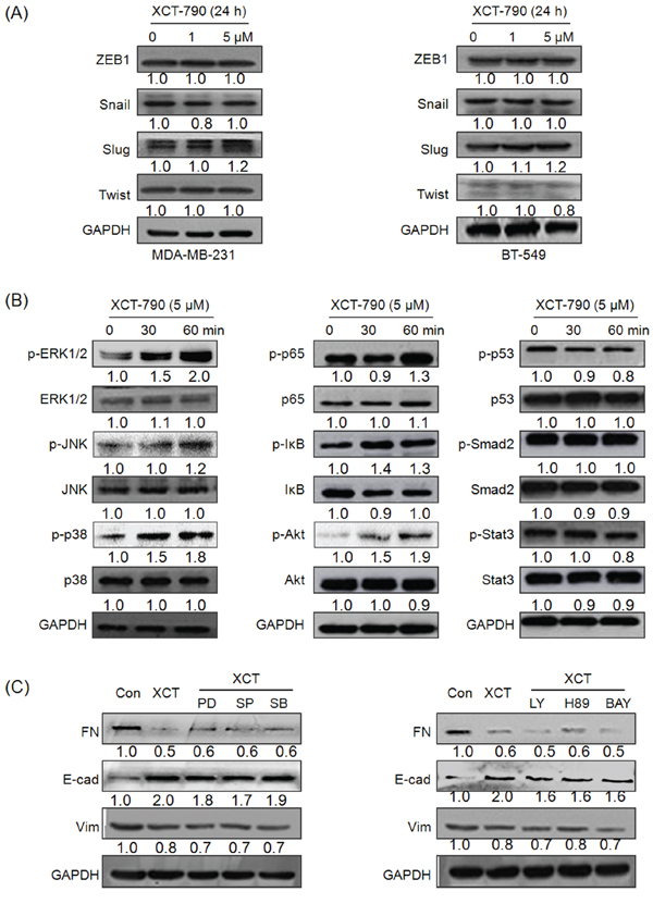 EMT related transcription factors and signal pathways including MAPK, PI3K/Akt, NF-&#x03BA;B do not mediate the suppression effects of XCT-790 on EMT.