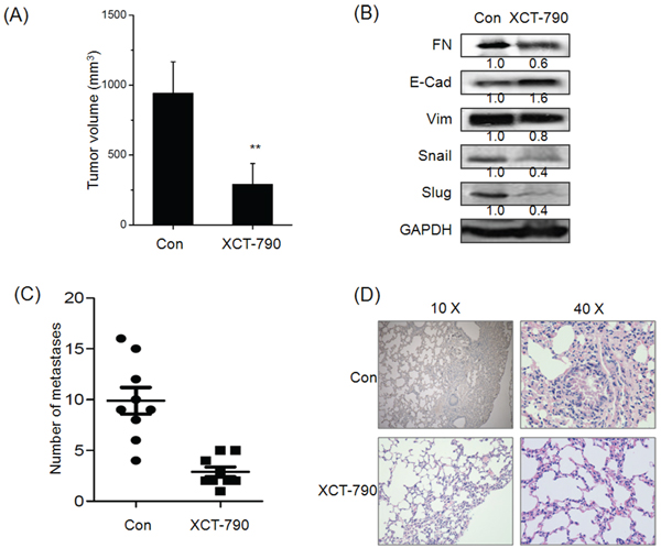 Targeted inhibition of ERR&#x03B1; inhibits the growth and metastasis of TNBC in vivo.