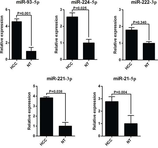 RT-PCR analysis of upregulated miRNAs expression in the HCC tissues and the adjacent noncancerous liver tissues.