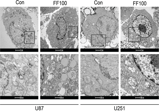 TEM images showing mitochondrial structural damage induced by FF (100 &#x03BC;M) in human glioblastoma cells.