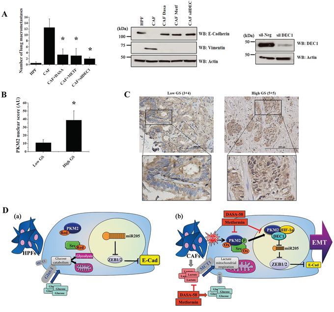 Nuclear translocation of PKM2 correlates with prostate carcinoma aggressiveness and with metastatic potential of PC3 cells.