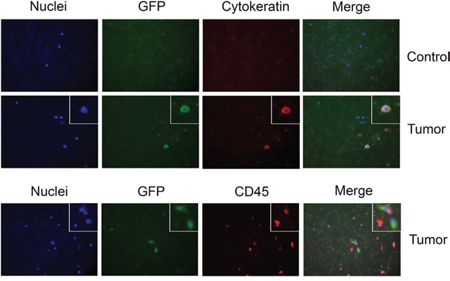 Detection of CTCs by InCTC. Mononuclear cells were enriched from blood samples of either a control nude mouse or a mouse with a xenograft tumor derived from NCI-H460-GFP cells were subjected to Matrigel invasion assay.