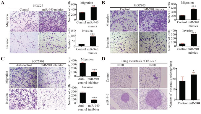 MiR-940 promotes migration and invasion of gastric cancer cells in vitro and metastasis in vivo.