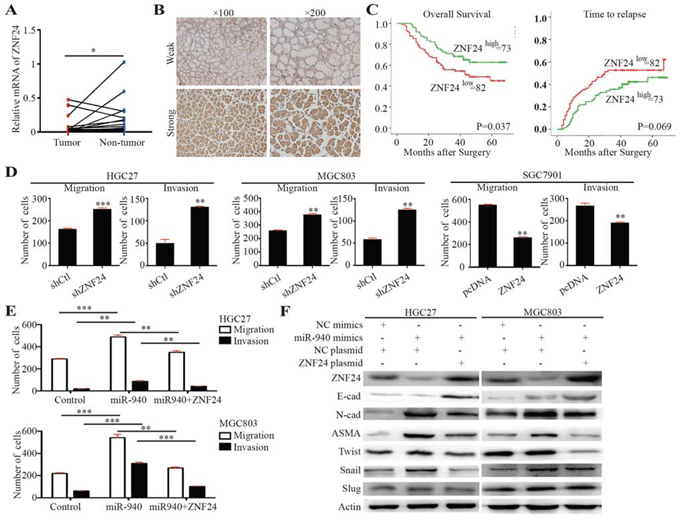 ZNF24 serves as a potential tumor suppressor and is inversely correlated with miR-940 expression in gastric cancer.