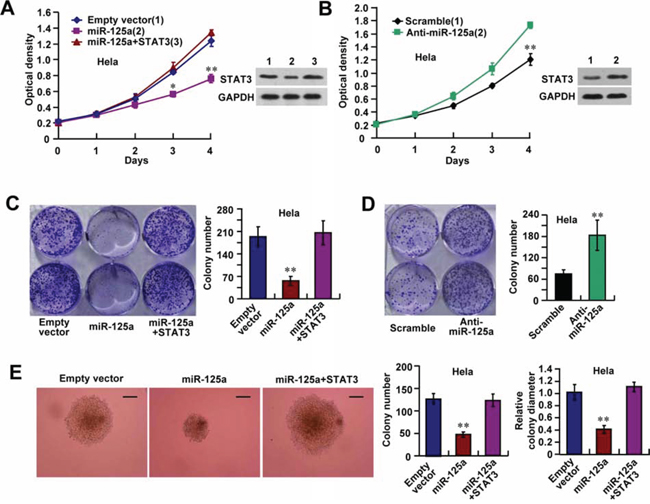 miR-125a suppresses cell proliferation through inhibition of STAT3 expression.
