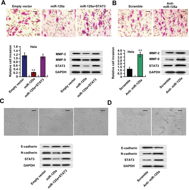 miR-125a inhibits invasion of CC cells via down-regulation of MMP-2, MMP-9 expression and EMT.