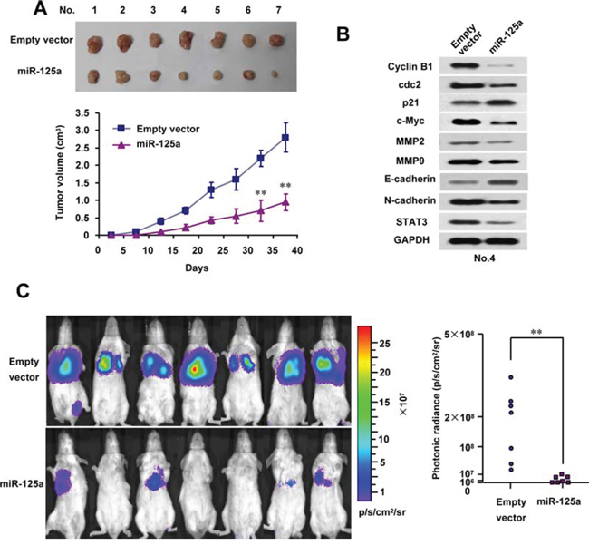 MiR-125a reduces tumor growth and metastasis of CC cell lines in vivo.