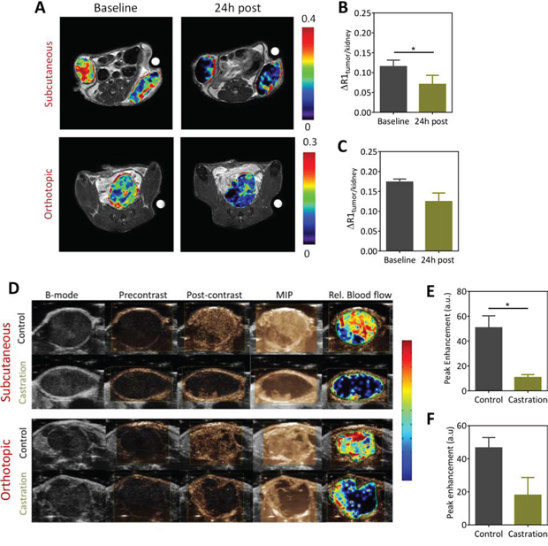 Contrast-enhanced MRI (CE-MRI) and contrast-enhanced ultrasound (CE-US) of Myc-CaP tumor vascular response to castration.