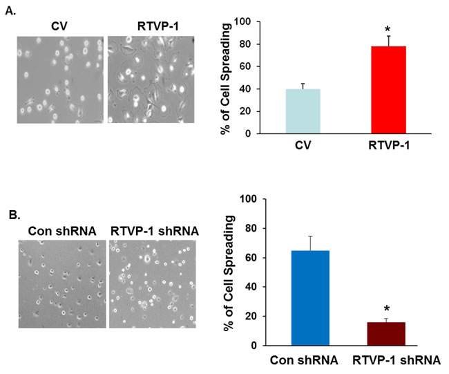 The effect of RTVP-1 on glioma cell spreading and migration is mediated by N-WASP.